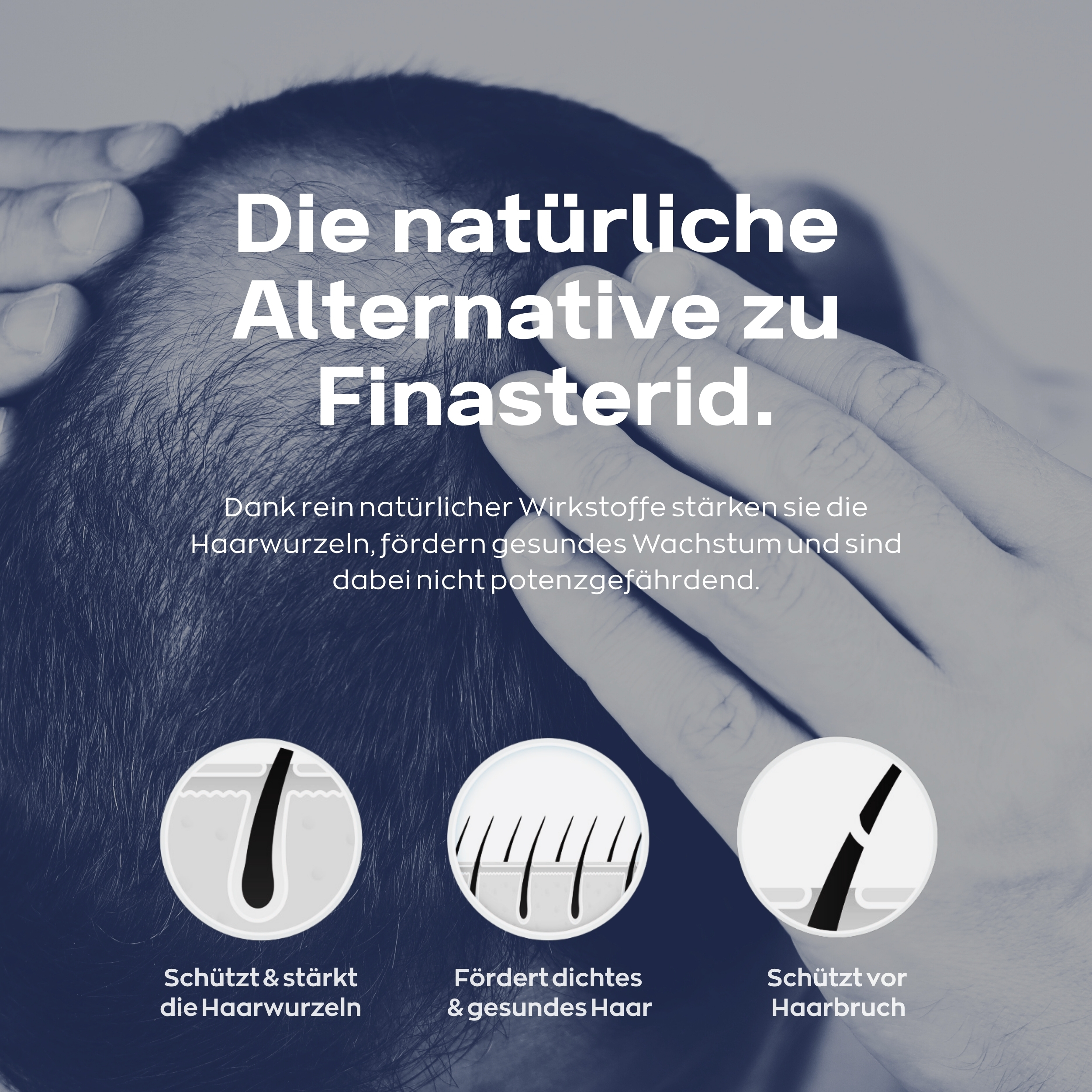 Xpecia Tabletten für Männer – Natürlicher DHT-Blocker gegen Haarausfall 12 Stück