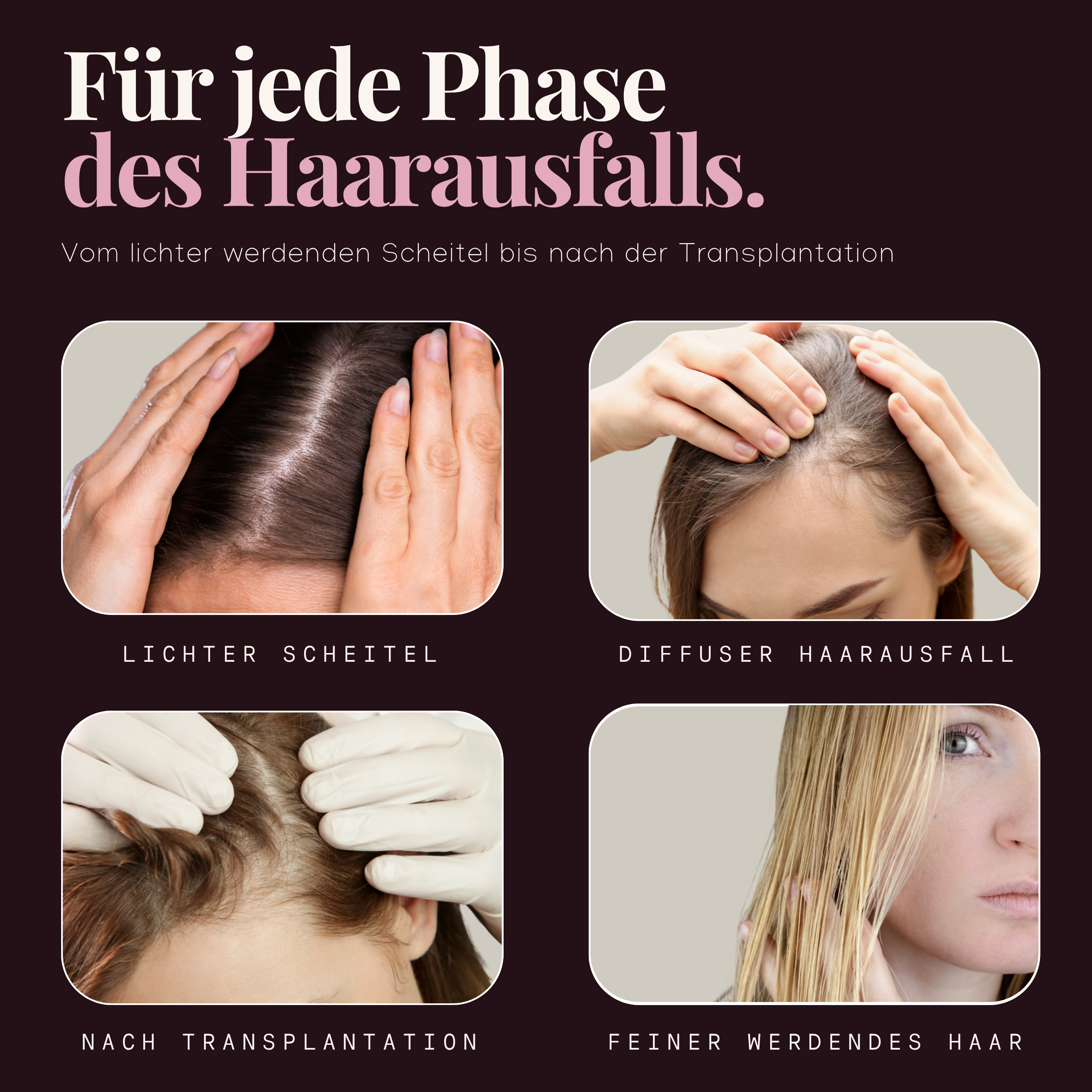 Hairforte Spray für Frauen 2% Procapil gegen Haarverlust DHT Blocker 3er Set